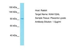 KIAA1324L Rabbit anti-Human, Polyclonal, Novus Biologicals 0.1ml; Unconjugated:Antibodies,